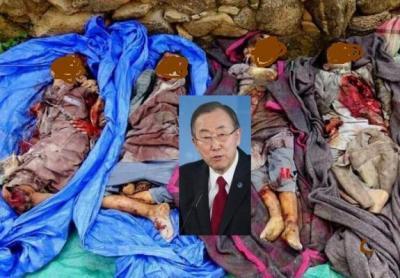 Almotamar Net - The United Nations Secretary-General condemned on Monday airstrikes on a school in Saada province, killing at least 10 children and injured dozens.

According to a statement issued by his spokesperson, Secretary-General Ban Ki-moon expressed "dismay" that civilians, including children, continue to bear the brunt of increased fighting and military operations in Yemen.

Ban called for a swift investigation of the tragic event in Saada and urged the parties to the ongoing conflict to take all necessary measures to prevent further violations of international humanitarian law and human rights and do everything in 