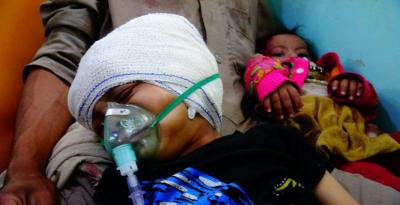 المؤتمر نت - استشهد مواطن وأصيب 7 آخرين بينهم طفلان اليوم بعدوان جديد على محافظتي صعدة والحديدة