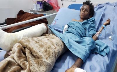 المؤتمر نت - أُصيب طفلان بجروح خطيرة نتيجة انفجار لغم من مخلفات العدوان الأمريكي السعودي الإماراتي في مديرية التحيتا محافظة الحديدة