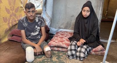 المؤتمر نت - قالت وزارة الصحة في غزة، الثلاثاء، إنها سجّلت 6 آلاف حالة بتر خلال عامين من الإبادة الإسرائيلية على القطاع، مشيرة إلى أنهم بحاجة إلى برامج تأهيل عاجلة